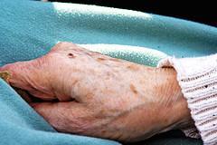 Wie man Pigmentflecken auf natürliche Weise entfernen kann