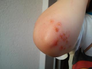 Komische Kinderkrankheiten