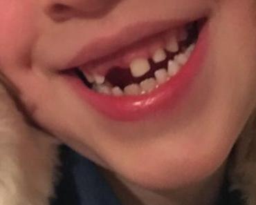 Mademoiselle Zahnlücke