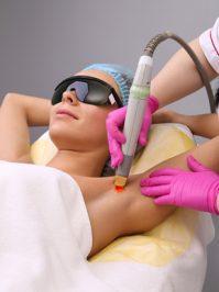 Dauerhafte Haarentfernung durch Lichtenergie