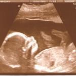 Wie entwickelt sich das Baby im Verlauf der Schwangerschaft?