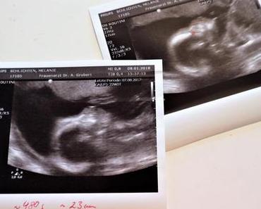 Schwangerschaft #3 (14-23 Woche)