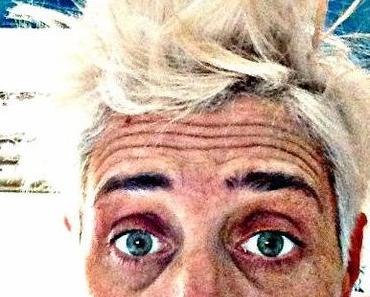 Das Hair Doctor Botschafter Projekt – Wir durften dabei sein