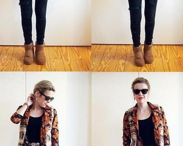 Spreiz- Senk- Fuß,...