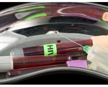 HIV verliert seinen Schrecken