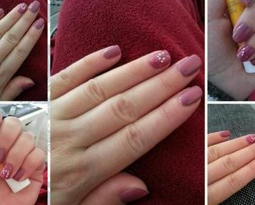 NOTD
