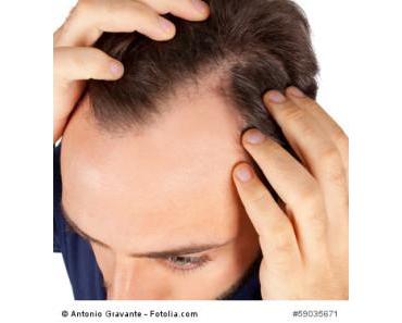 Symptome des Haarausfalls